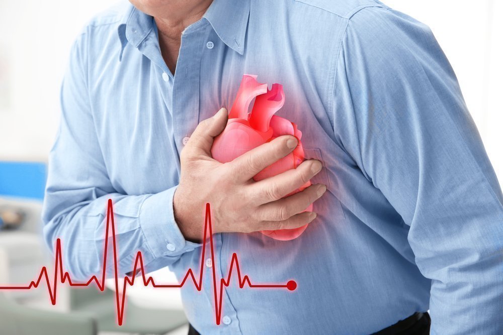 Как предотвратить инфаркт? Профилактика инфаркта и инсульта у мужчин и женщин.